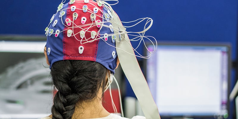 QEEG